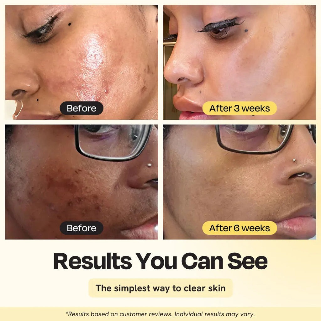 Jumbo Vitamin C Clay Mask Gleamin