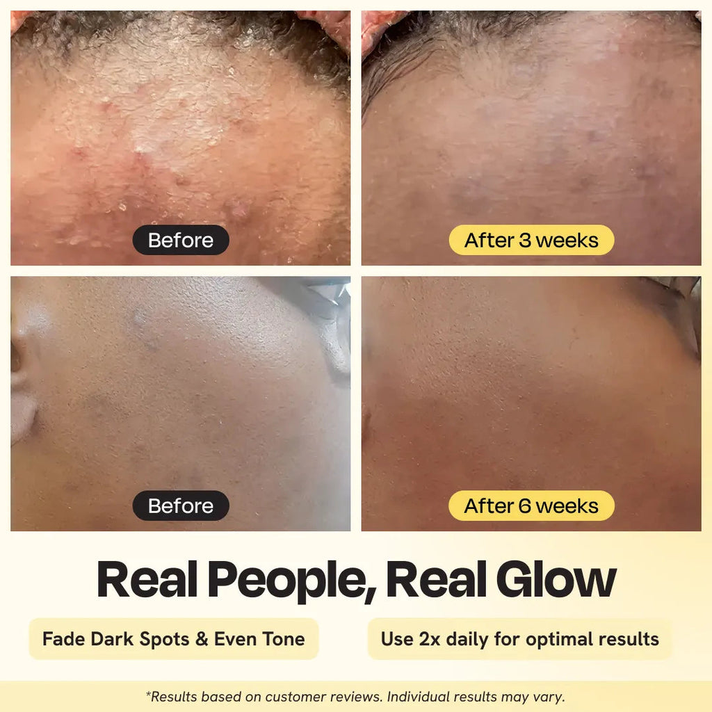 Advanced Brightening Moisturizer Gleamin